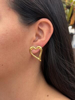 aretes 75